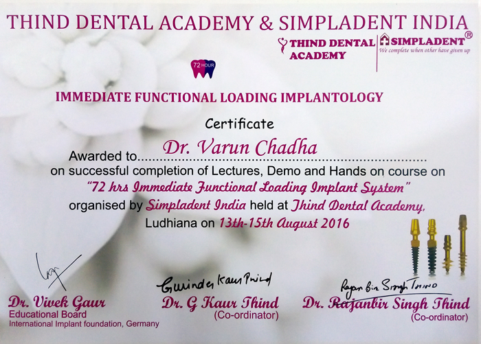 Immediate Functional Loading Implantology