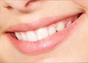 Before - Single Molar Implant